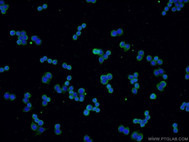 VCP Antibody in Immunocytochemistry (ICC/IF)