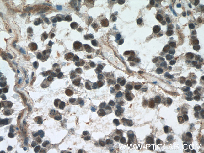 VCP Antibody in Immunohistochemistry (Paraffin) (IHC (P))