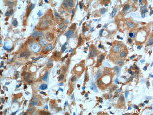 GOT1 Antibody in Immunohistochemistry (Paraffin) (IHC (P))