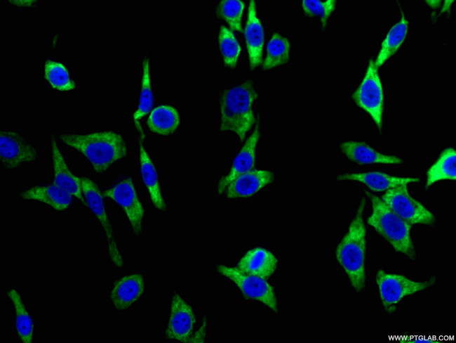 HSP90 Antibody in Immunocytochemistry (ICC/IF)