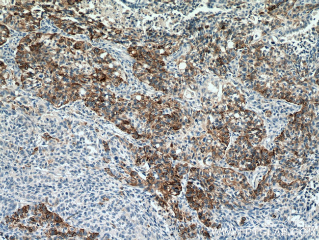 Cytokeratin 14 Antibody in Immunohistochemistry (Paraffin) (IHC (P))