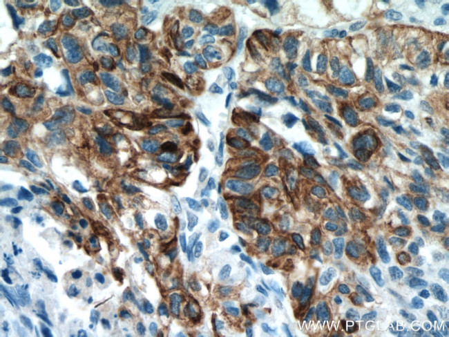 Cytokeratin 14 Antibody in Immunohistochemistry (Paraffin) (IHC (P))