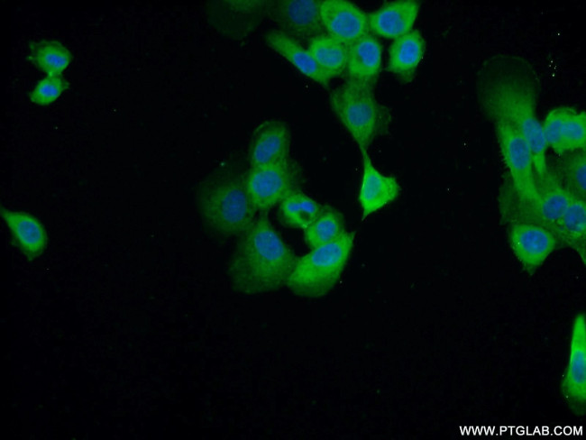 Cytokeratin 14 Antibody in Immunocytochemistry (ICC/IF)