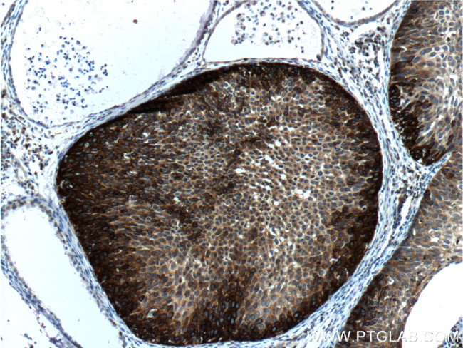 Cytokeratin 14 Antibody in Immunohistochemistry (Paraffin) (IHC (P))