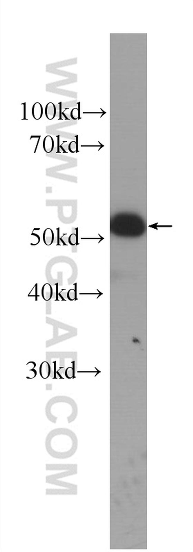 Cytokeratin 14 Antibody in Western Blot (WB)