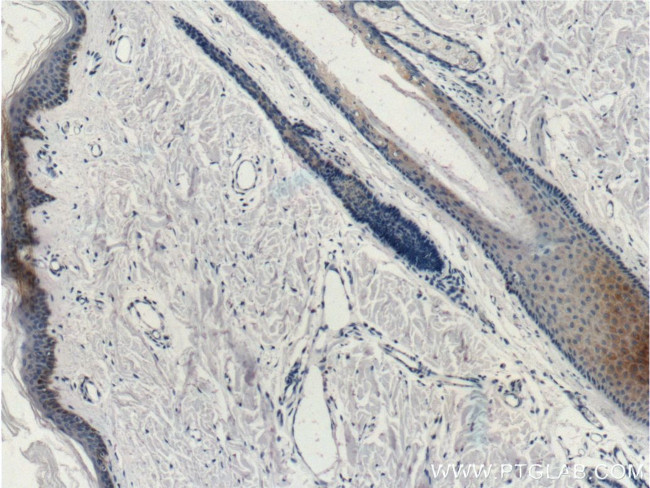 Cytokeratin 14 Antibody in Immunohistochemistry (Paraffin) (IHC (P))