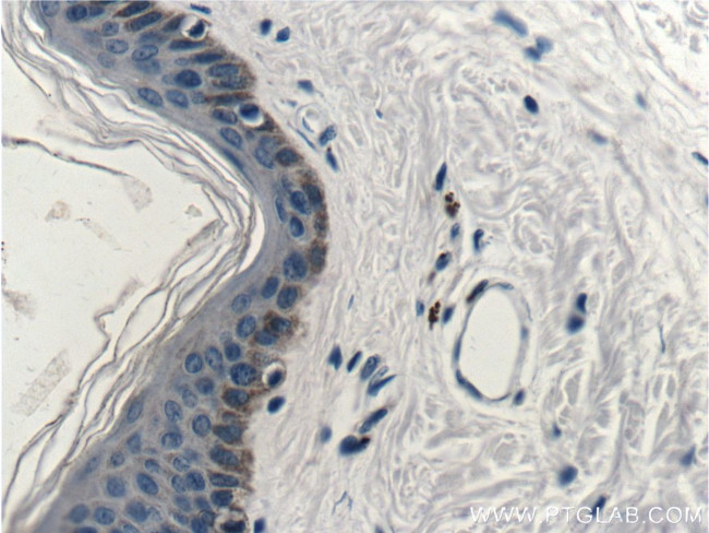 Cytokeratin 14 Antibody in Immunohistochemistry (Paraffin) (IHC (P))