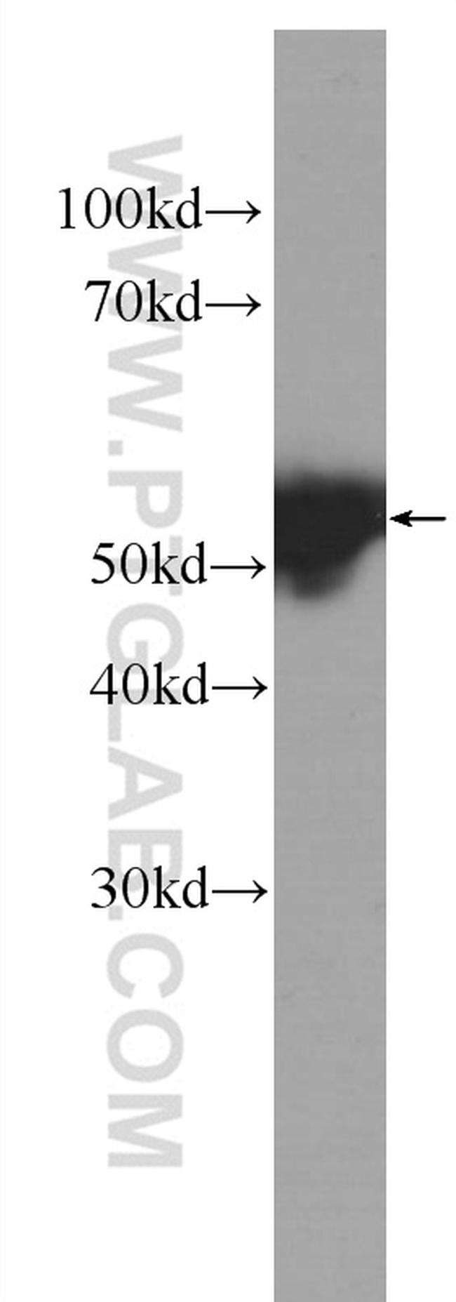 Cytokeratin 14 Antibody in Western Blot (WB)