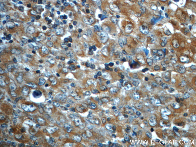 ALK/CD246 Antibody in Immunohistochemistry (Paraffin) (IHC (P))