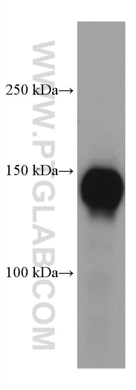 P-selectin Antibody in Western Blot (WB)