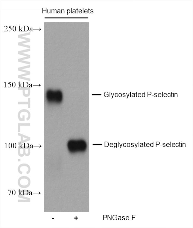 P-selectin Antibody in Western Blot (WB)