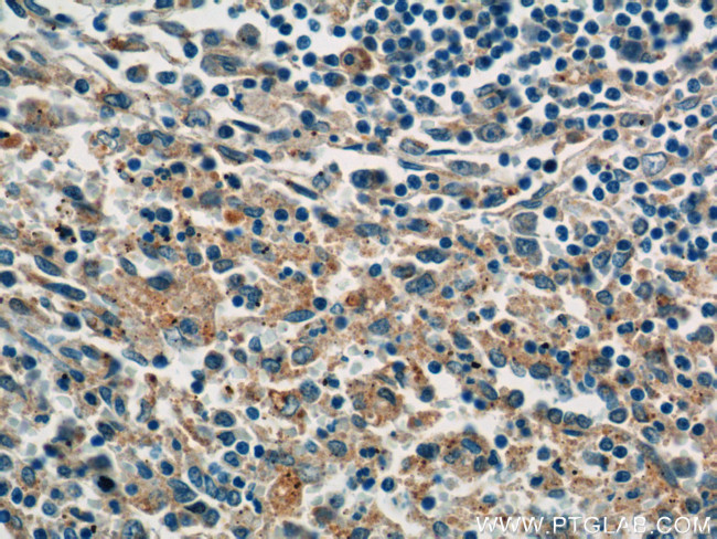 P-selectin Antibody in Immunohistochemistry (Paraffin) (IHC (P))