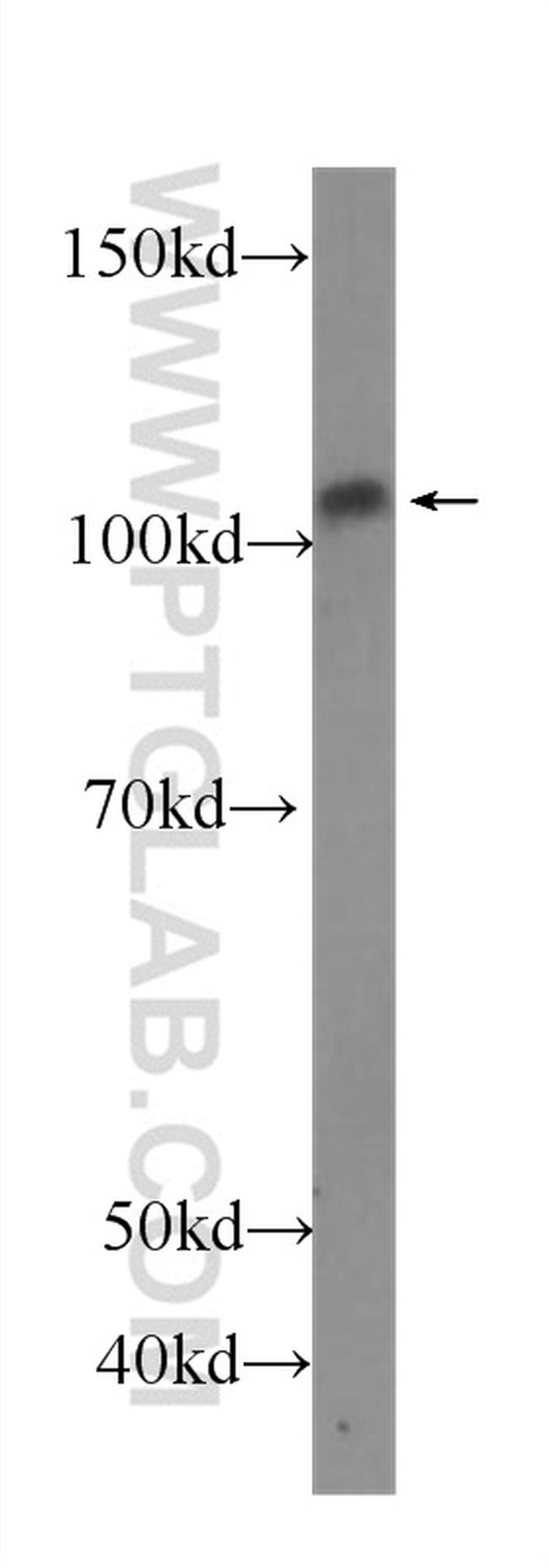 P-selectin Antibody in Western Blot (WB)