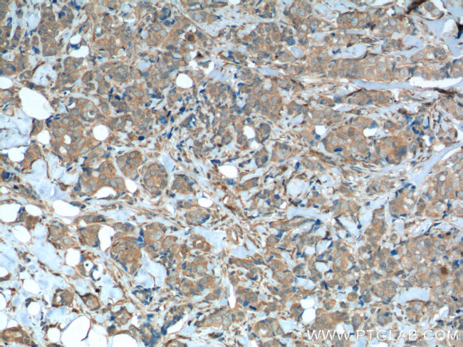 FGFR1 Antibody in Immunohistochemistry (Paraffin) (IHC (P))