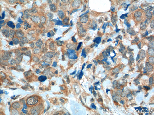 FGFR1 Antibody in Immunohistochemistry (Paraffin) (IHC (P))