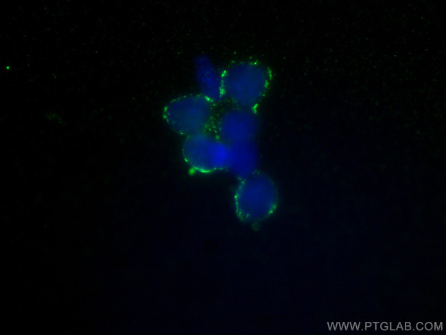 Bestrophin-1 Antibody in Immunocytochemistry (ICC/IF)