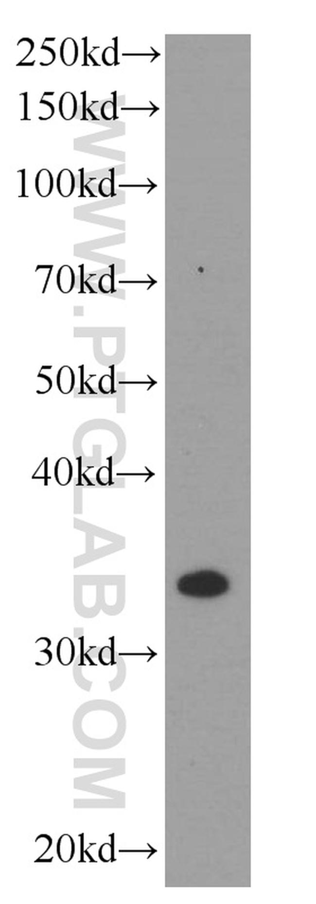 TNFAIP1 Antibody in Western Blot (WB)
