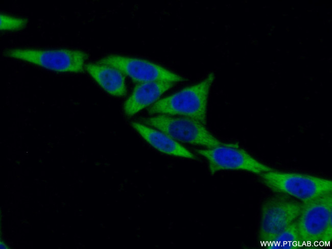 EEF1B2 Antibody in Immunocytochemistry (ICC/IF)