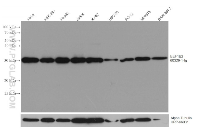 EEF1B2 Antibody in Western Blot (WB)