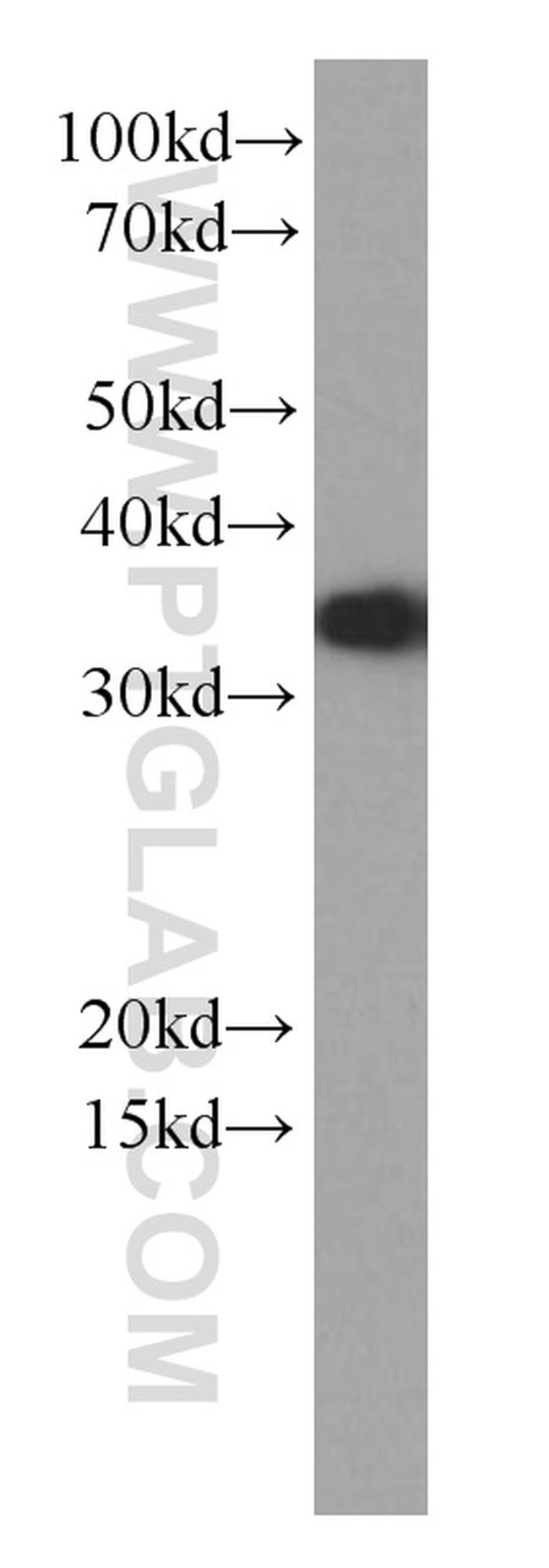 EEF1B2 Antibody in Western Blot (WB)