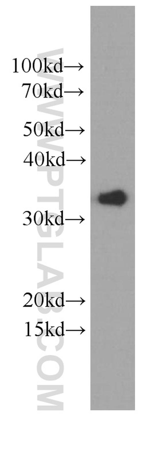 EEF1B2 Antibody in Western Blot (WB)