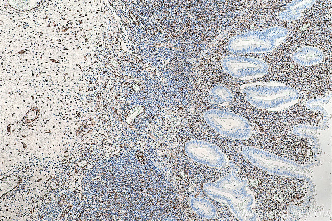 Vimentin Antibody in Immunohistochemistry (Paraffin) (IHC (P))