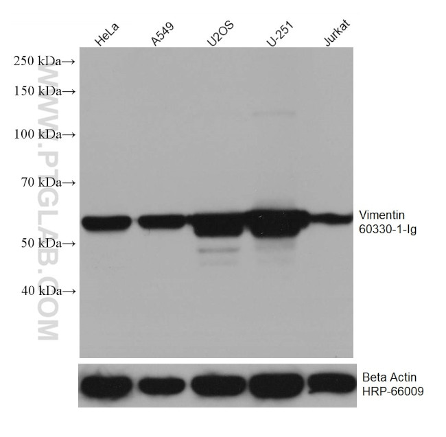 Vimentin Antibody in Western Blot (WB)