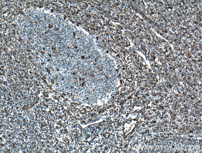 Vimentin Antibody in Immunohistochemistry (Paraffin) (IHC (P))