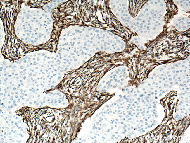 Vimentin Antibody in Immunohistochemistry (Paraffin) (IHC (P))