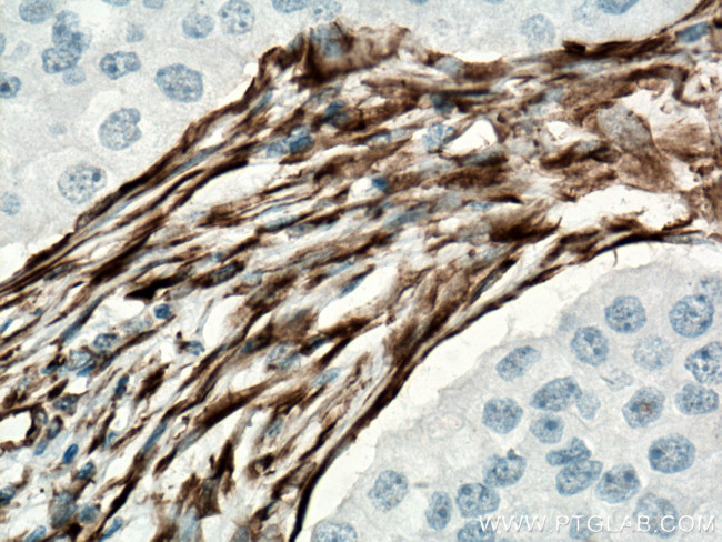 Vimentin Antibody in Immunohistochemistry (Paraffin) (IHC (P))