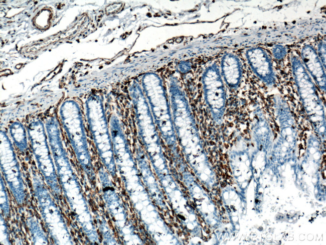 Vimentin Antibody in Immunohistochemistry (Paraffin) (IHC (P))