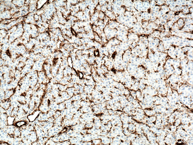 Vimentin Antibody in Immunohistochemistry (Paraffin) (IHC (P))