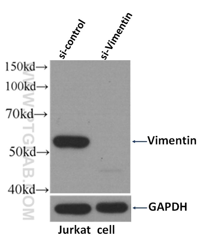 Vimentin Antibody in Western Blot (WB)