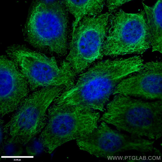 Vimentin Antibody in Immunocytochemistry (ICC/IF)