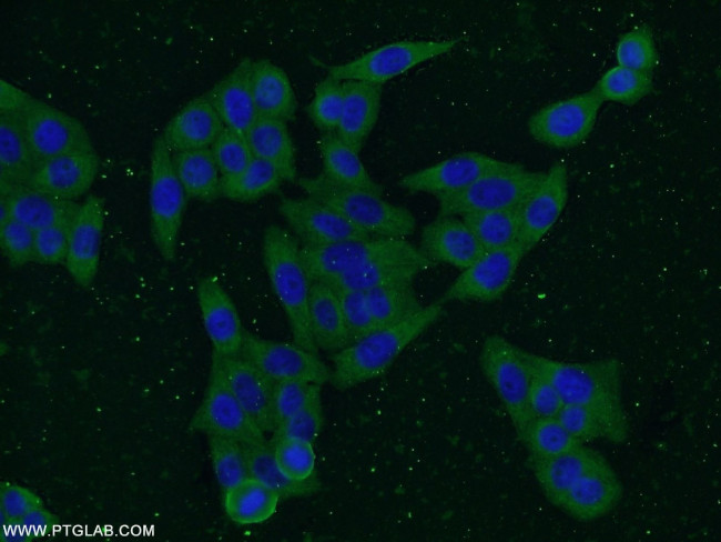 Vimentin Antibody in Immunocytochemistry (ICC/IF)