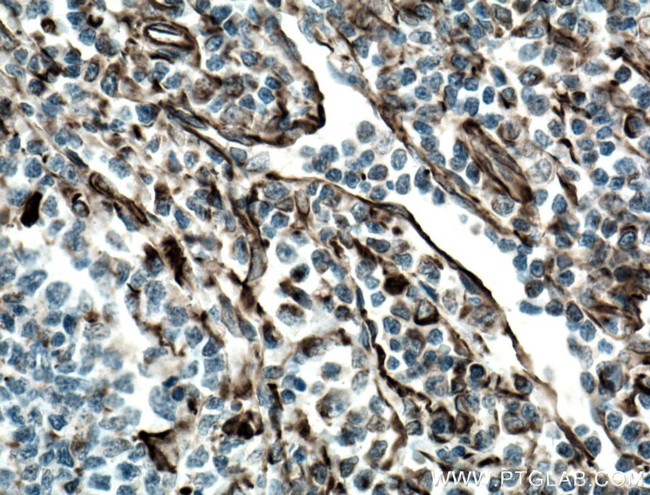 Vimentin Antibody in Immunohistochemistry (Paraffin) (IHC (P))