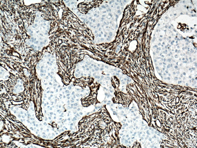 Vimentin Antibody in Immunohistochemistry (Paraffin) (IHC (P))