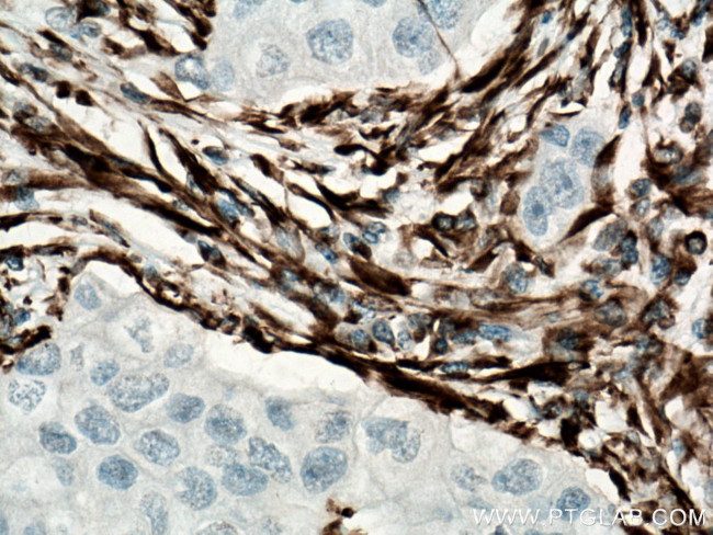 Vimentin Antibody in Immunohistochemistry (Paraffin) (IHC (P))