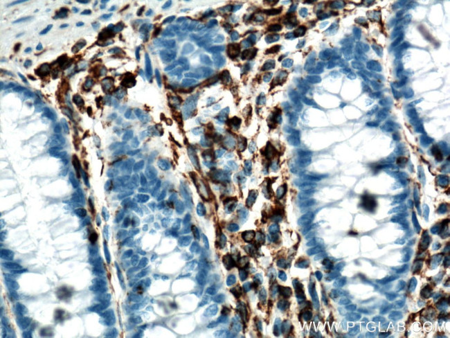 Vimentin Antibody in Immunohistochemistry (Paraffin) (IHC (P))