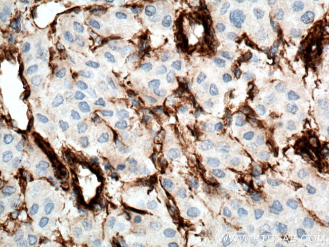 Vimentin Antibody in Immunohistochemistry (Paraffin) (IHC (P))