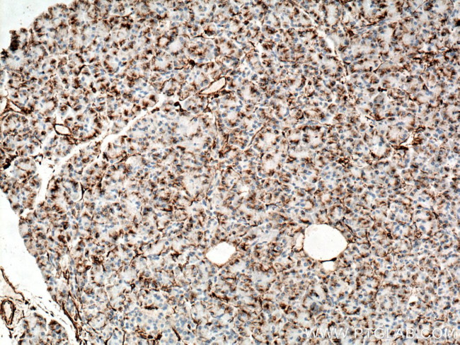 Vimentin Antibody in Immunohistochemistry (Paraffin) (IHC (P))