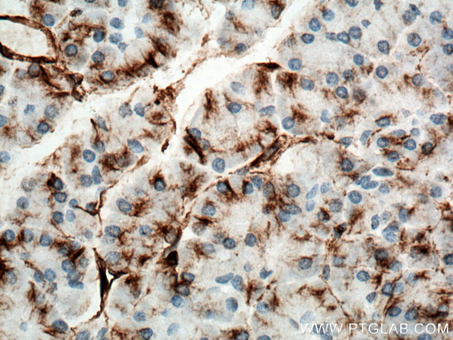 Vimentin Antibody in Immunohistochemistry (Paraffin) (IHC (P))