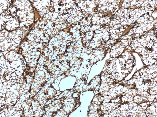 Vimentin Antibody in Immunohistochemistry (Paraffin) (IHC (P))