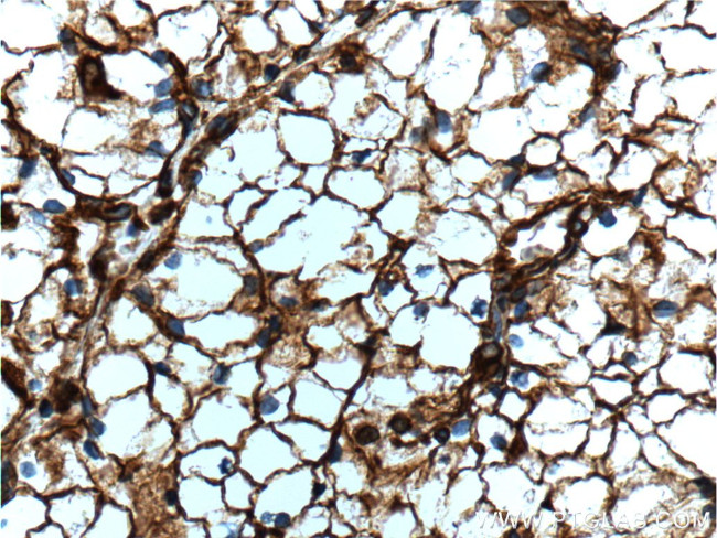 Vimentin Antibody in Immunohistochemistry (Paraffin) (IHC (P))