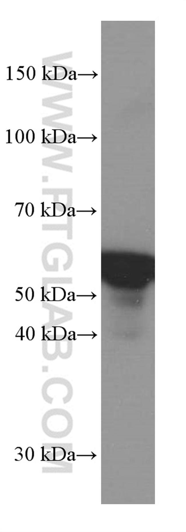 Vimentin Antibody in Western Blot (WB)