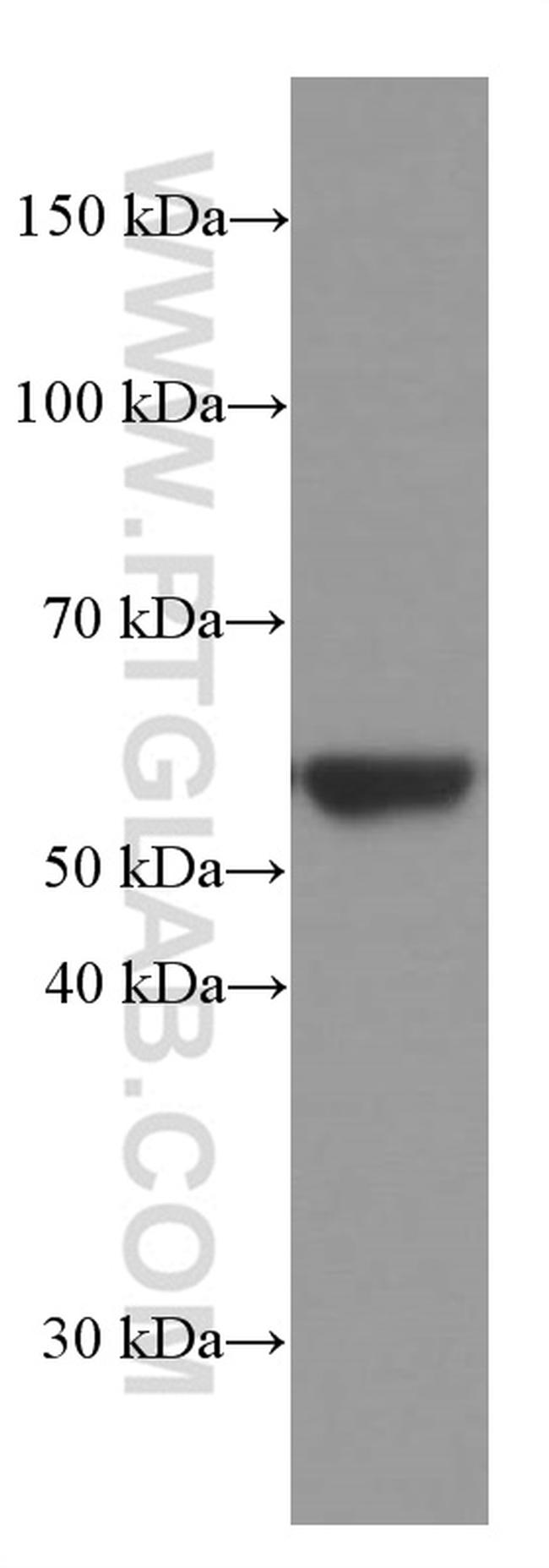 Vimentin Antibody in Western Blot (WB)