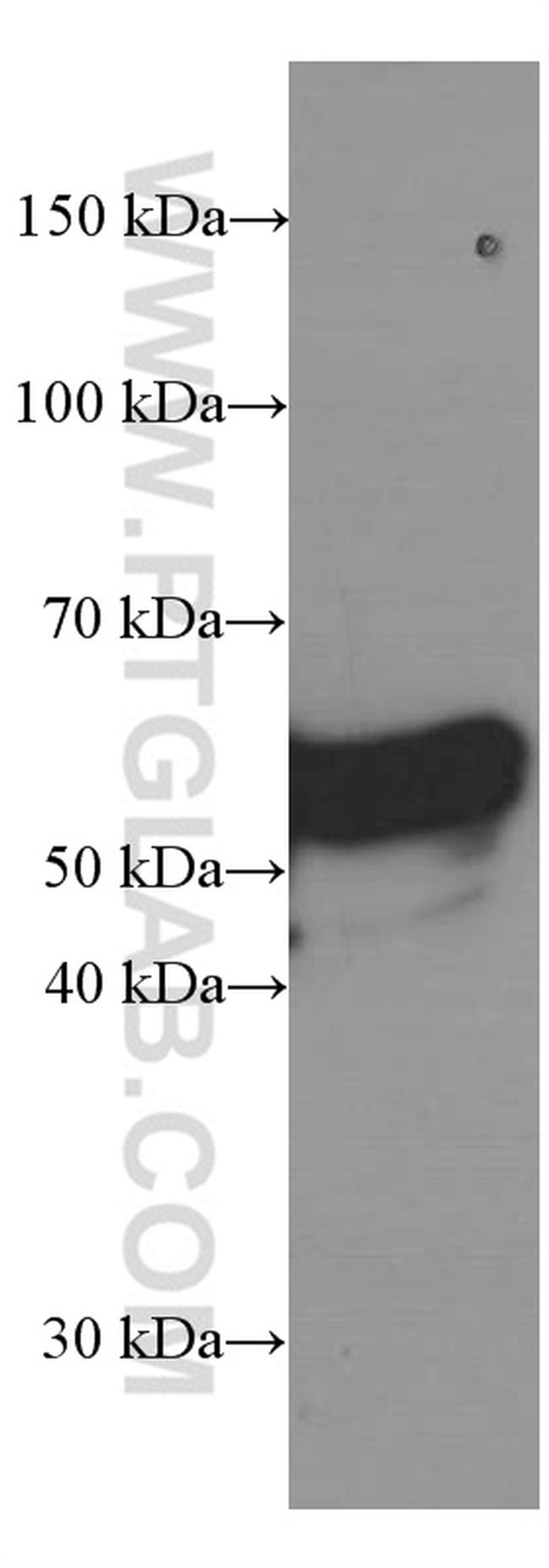 Vimentin Antibody in Western Blot (WB)