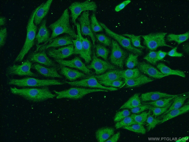 NF-H Antibody in Immunocytochemistry (ICC/IF)