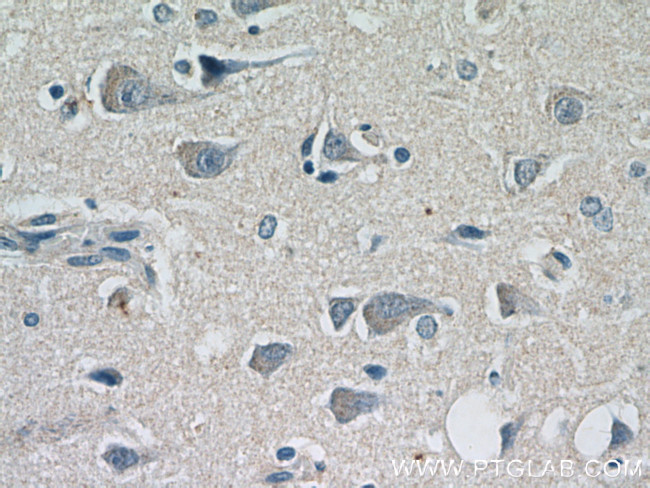 NF-H Antibody in Immunohistochemistry (Paraffin) (IHC (P))