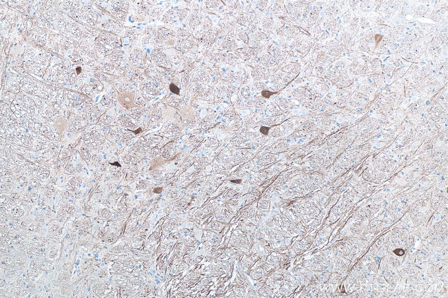 NF-H Antibody in Immunohistochemistry (Paraffin) (IHC (P))